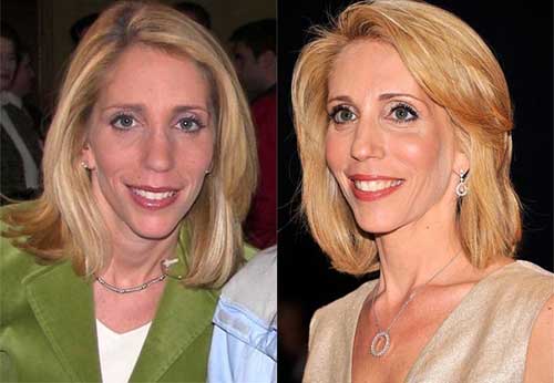 Dana Bash No Makeup Natural Look