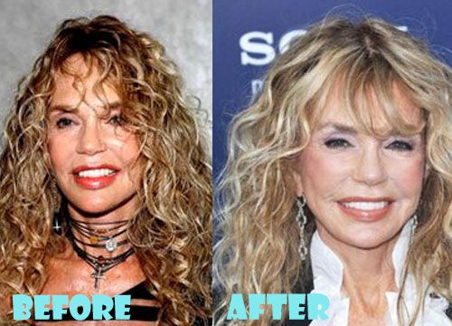 Dyan Cannon Without Makeup Photo