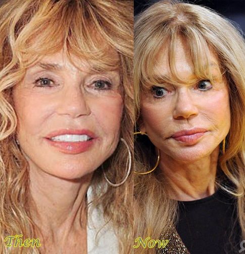 Dyan Cannon Without Makeup