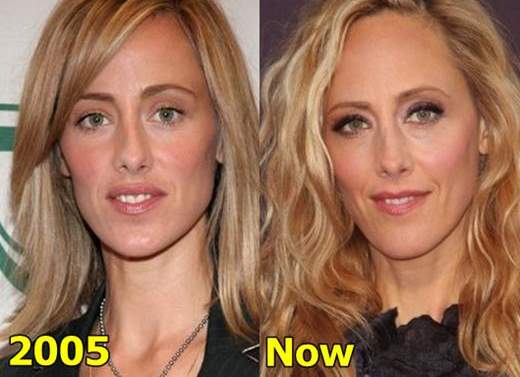 Kim Raver No Makeup Natural Look