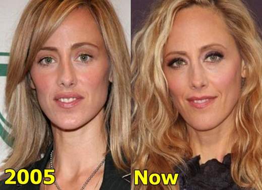 Kim Raver No Makeup Natural Look