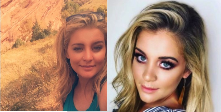 Lauren Alaina Without Makeup