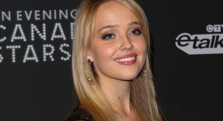 Siobhan Williams Without Cosmetics