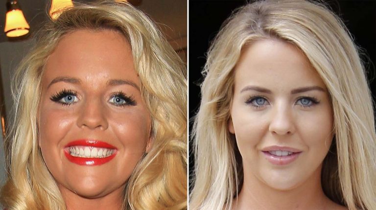 Lydia Bright Without Makeup Natural Look