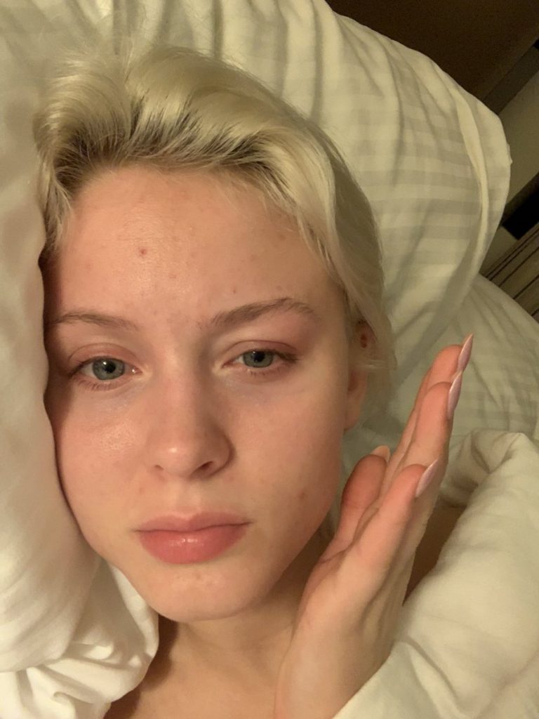 Zara Larsson Without Makeup Natural Look