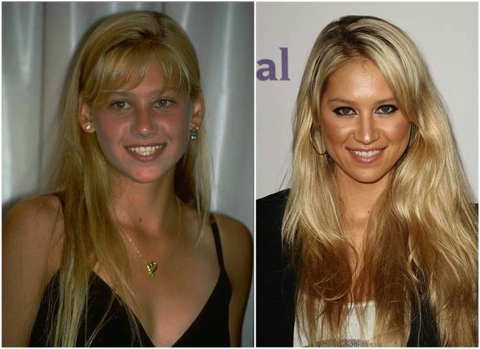 Anna Kournikova No Makeup Natural Look