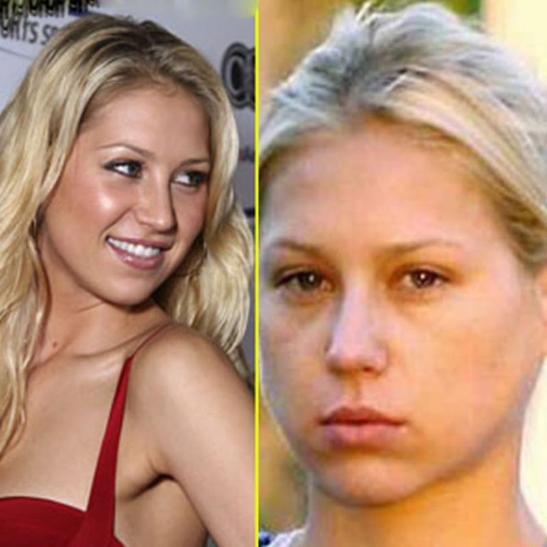 Anna Kournikova Without Makeup