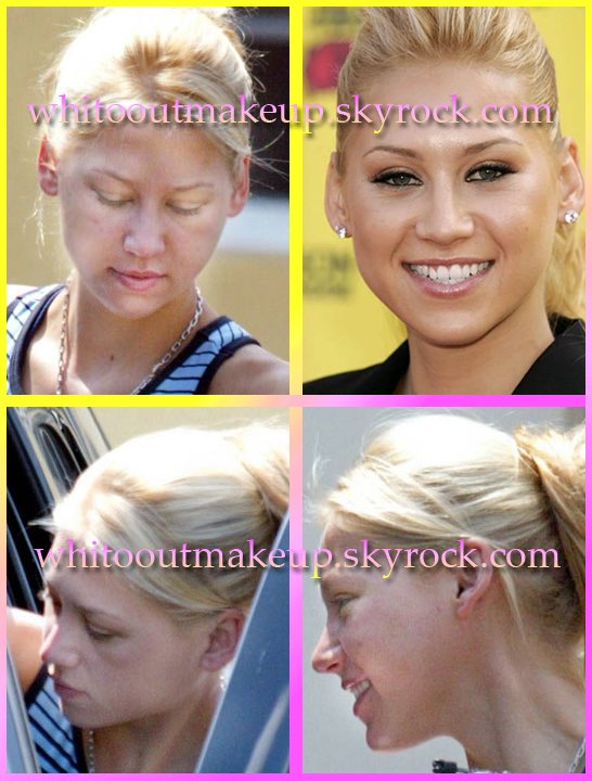 Anna Kournikova Without Makeup Photo