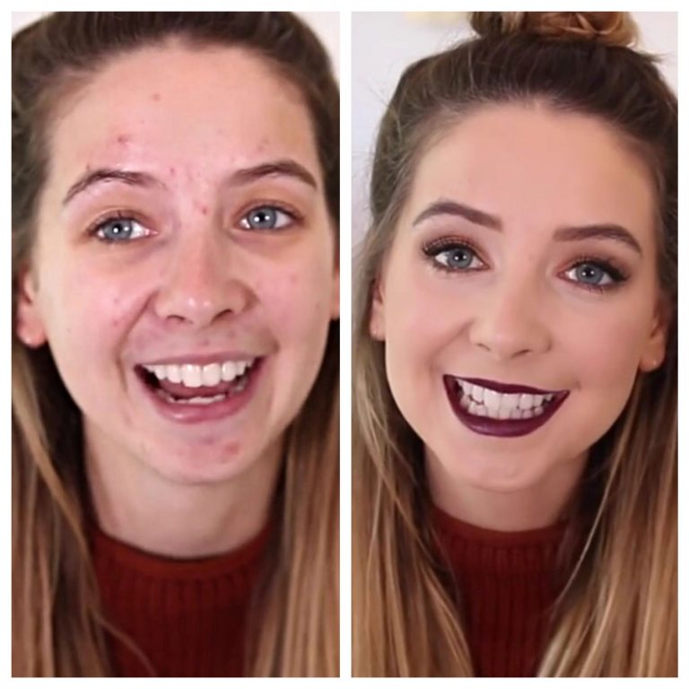 Zoe Sugg Without Makeup