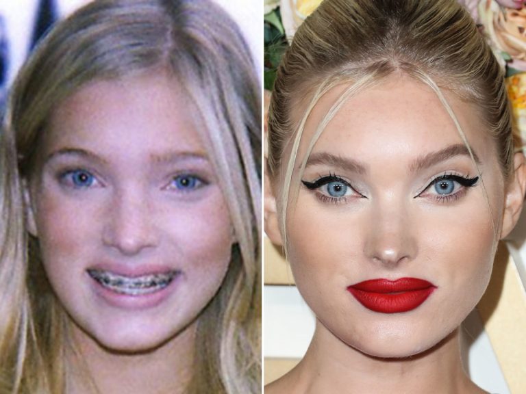 Elsa Hosk Without Makeup Photo