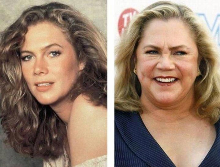 Kathleen Turner No Makeup