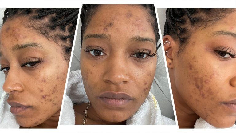 Keke Palmer Without Makeup Photo