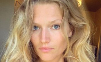 Toni Garrn Without Cosmetics