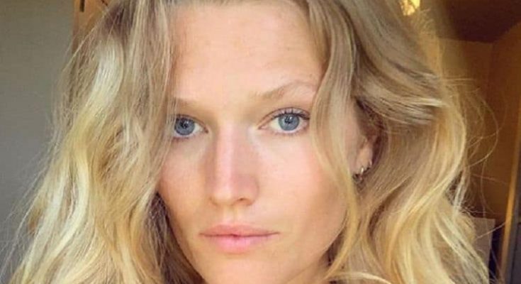 Toni Garrn Without Cosmetics