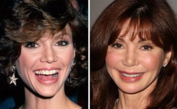 Victoria Principal Without Cosmetics