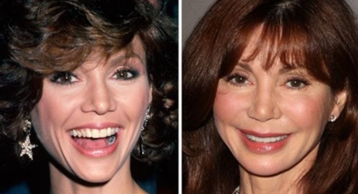Victoria Principal Without Cosmetics