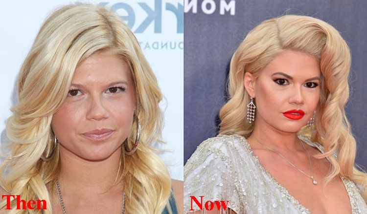 Chanel West Coast Without Makeup