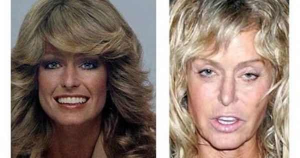 Farrah Fawcett No Makeup