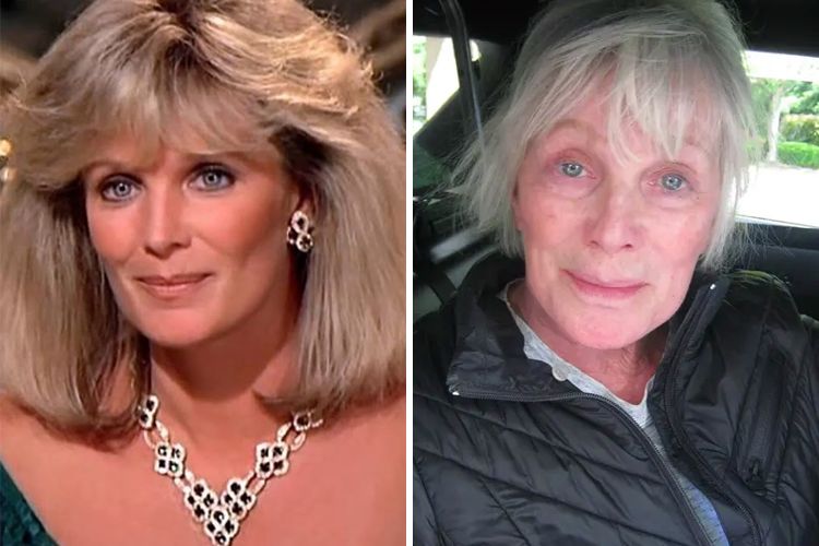 Linda Evans Without Makeup Photo